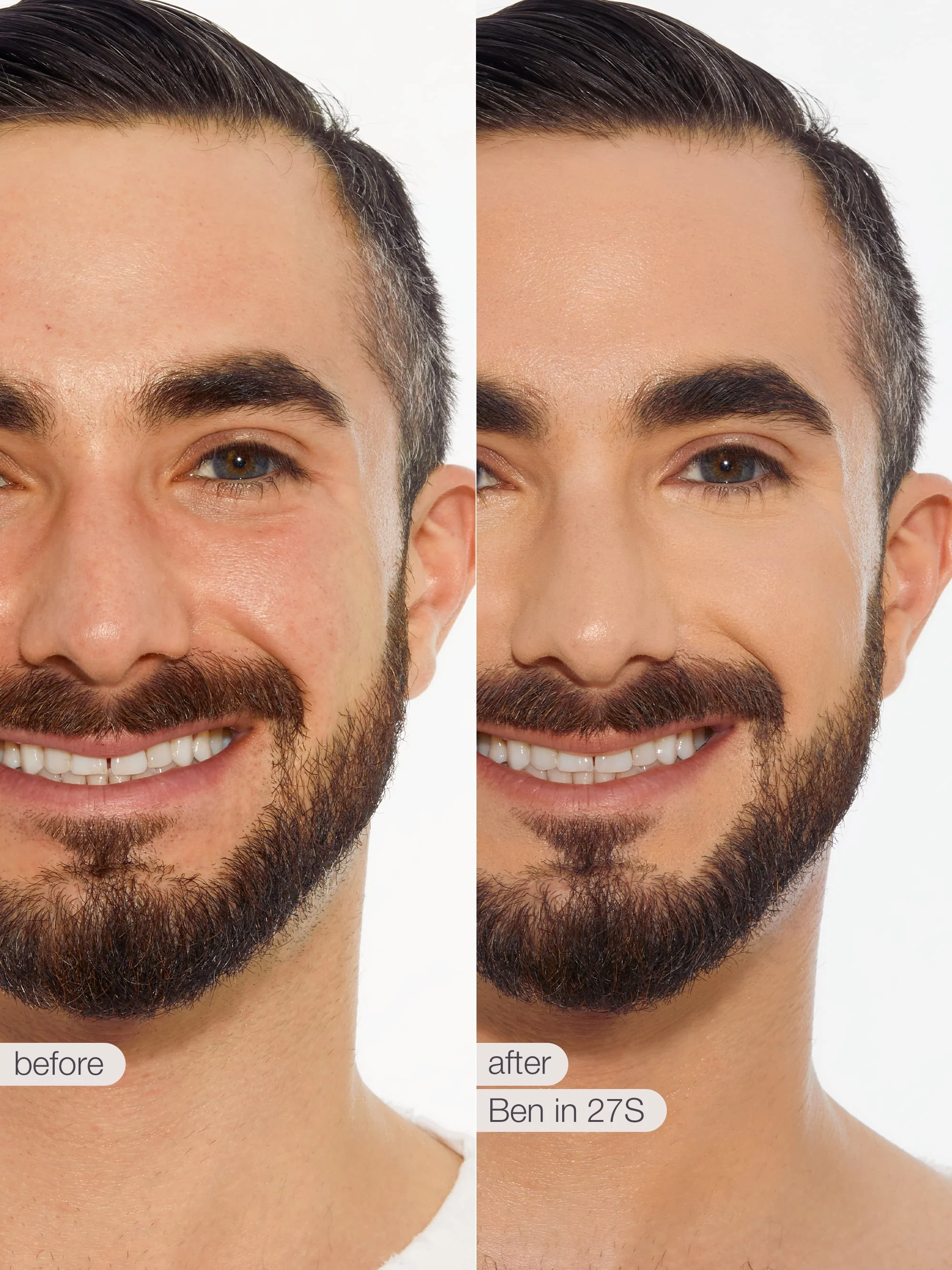 Product image 100